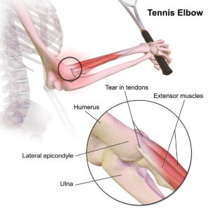 Muscle of the Elbow Anatomy